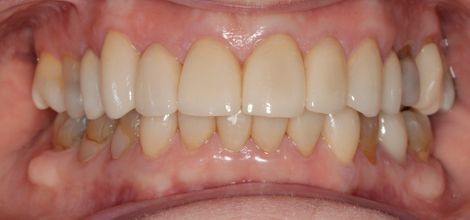After dental treatment at Broadway Dentistry After dental treatment at Broadway Dentistry