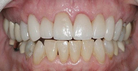 After dental treatment at Broadway Dentistry After dental treatment at Broadway Dentistry