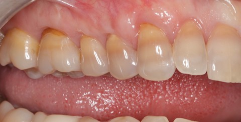 After dental treatment at Broadway Dentistry After dental treatment at Broadway Dentistry
