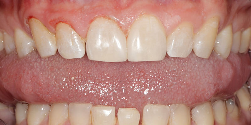before dental treatment at Broadway Dentistry before dental treatment at Broadway Dentistry