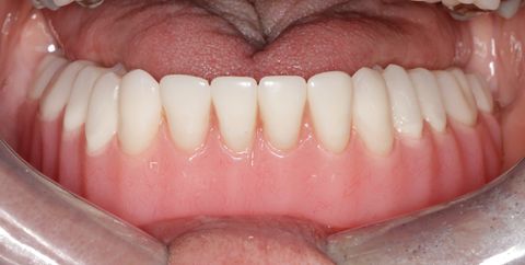 After dental treatment at Broadway Dentistry After dental treatment at Broadway Dentistry