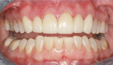 After dental treatment at Broadway Dentistry After dental treatment at Broadway Dentistry