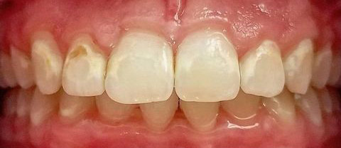 before dental treatment at Broadway Dentistry before dental treatment at Broadway Dentistry